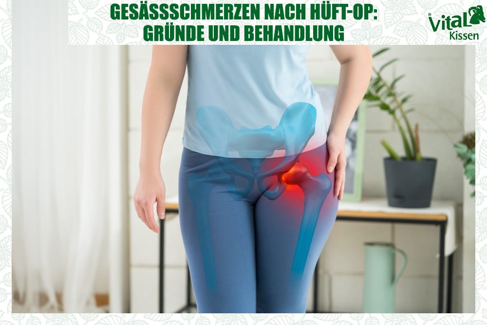 Gesäßschmerzen nach Hüft-OP: Gründe und Behandlung